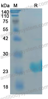 YMK01801, SDS-PAGE
