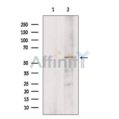 Валидация Affinity DF2600 - 13287