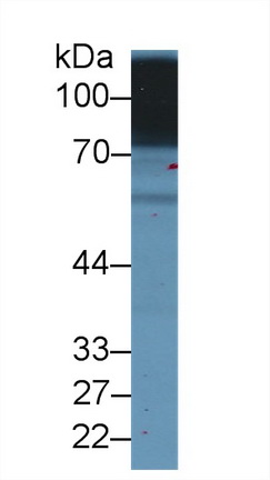 14417