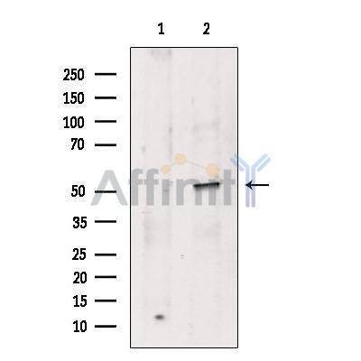 Валидация Affinity DF10071 - 5549