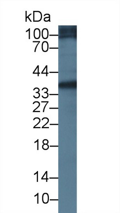 12760