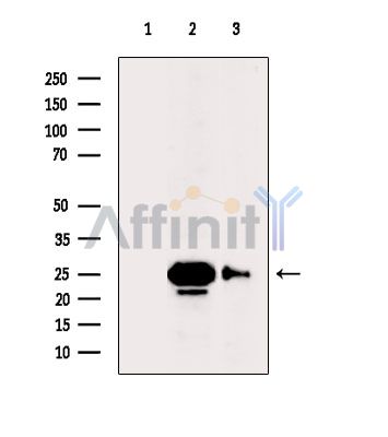 Валидация Affinity DF15561 - 11969