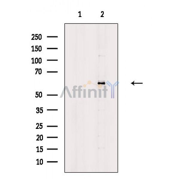 Валидация Affinity DF8634 - 20579