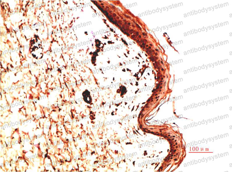 Валидация AntibodySystem RHB97702