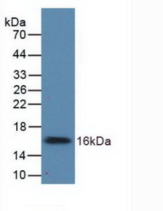 56381