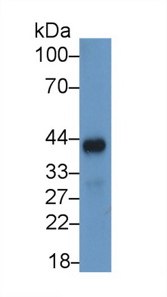 25755