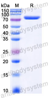 YHC30302, SDS-PAGE