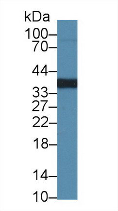 14956