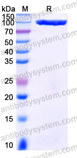 AHJ51602, SDS-PAGE