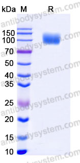 AHC21002, SDS-PAGE