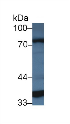 14300