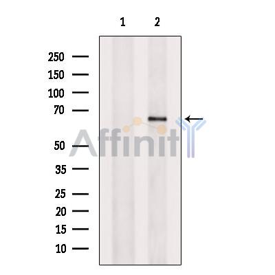 Валидация Affinity DF12073 - 6148