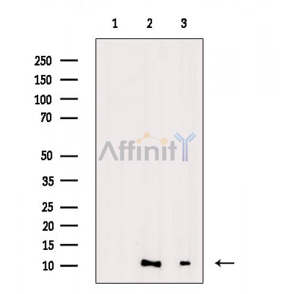 Валидация Affinity AF3636 - 2031
