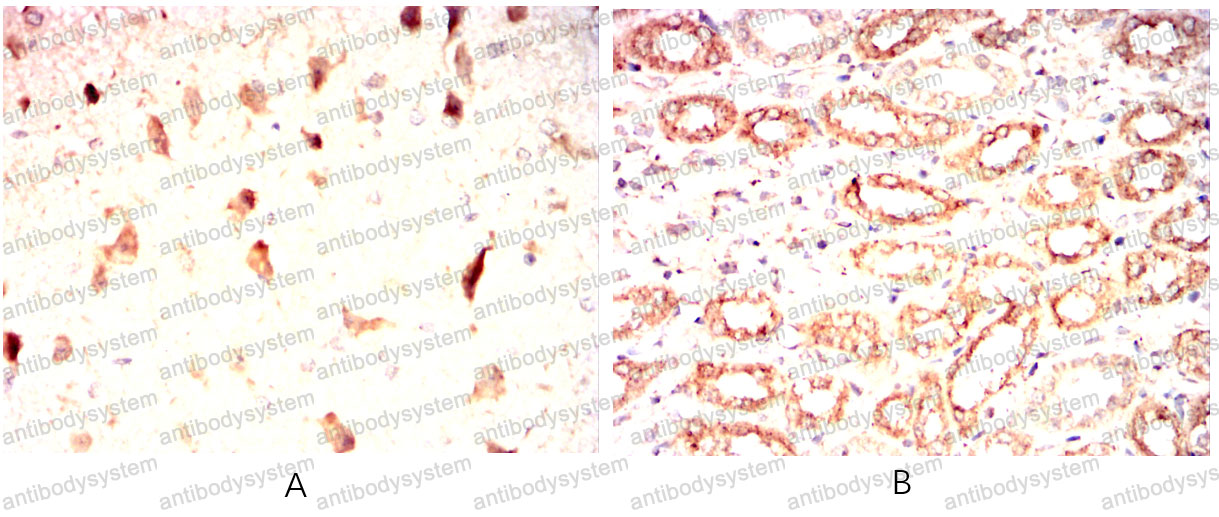 Валидация AntibodySystem RHA72203