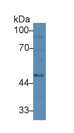 14599
