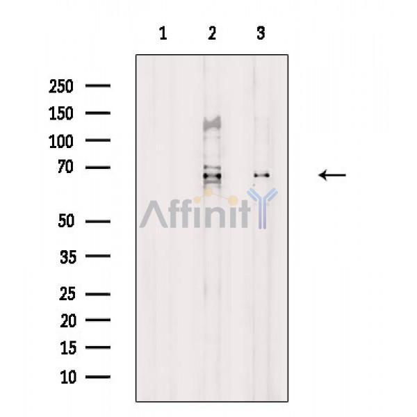 Валидация Affinity DF8637 - 20584