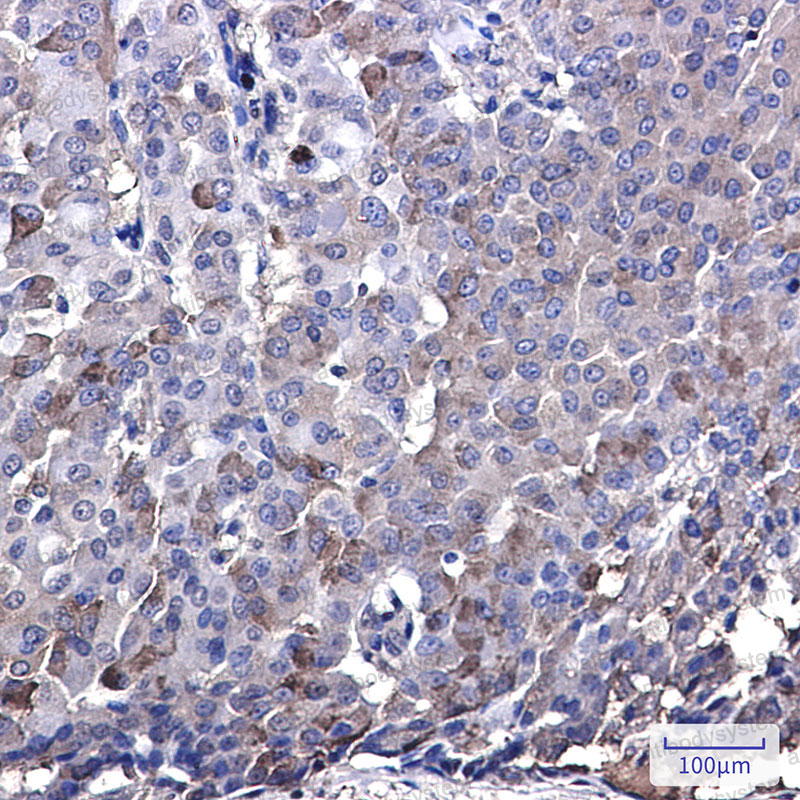 Валидация AntibodySystem RHJ35301