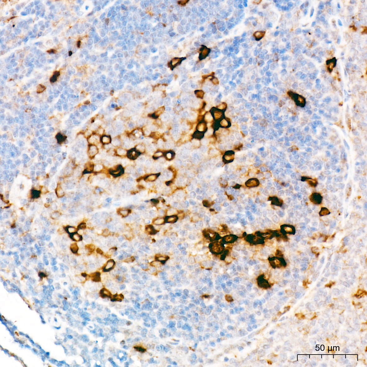 AP1471, иммуногистохимия, ткань селезенки крысы (25166)