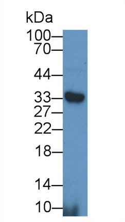 14721