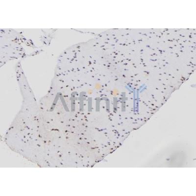 Валидация Affinity DF6606 - 18059