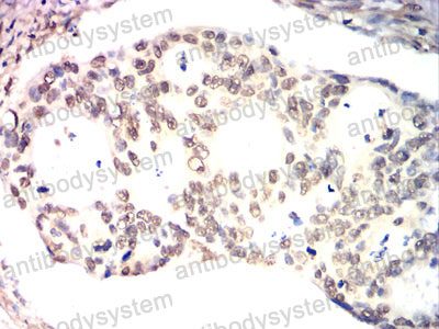 Валидация AntibodySystem RHD31502