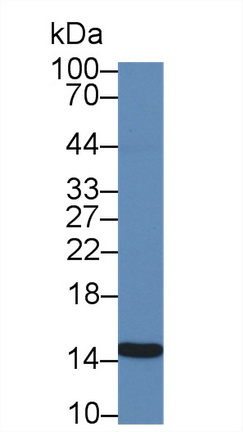 14847