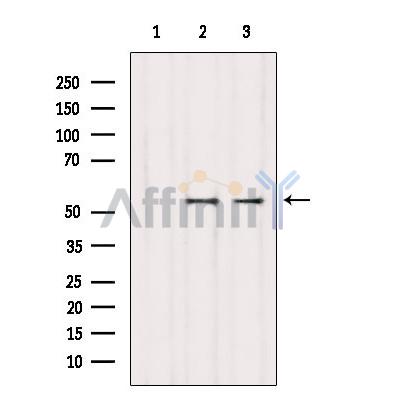 Валидация Affinity AF6097 - 3302