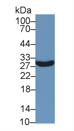 14182