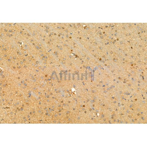 Валидация Affinity DF12100 - 6217