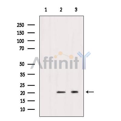 Валидация Affinity AF5372 - 2992