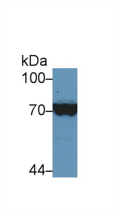 13872