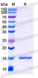 Валидация SDS-PAGE - AntibodySystem RHB92501