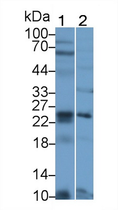 21397