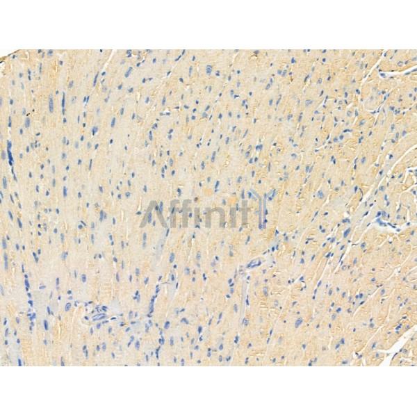 Валидация Affinity AF3972 - 2097