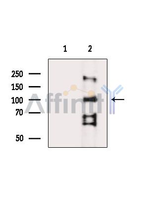 Валидация Affinity DF14191 - 10012