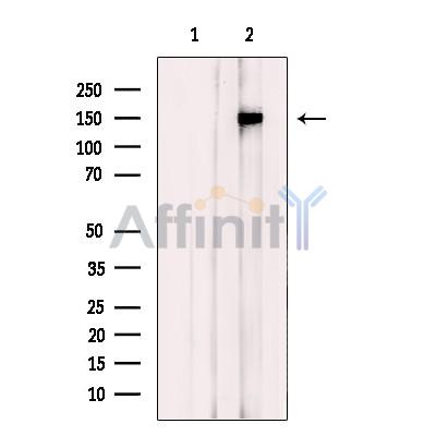 Валидация Affinity AF4779 - 2399