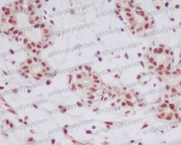 Валидация AntibodySystem RHE45802