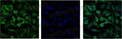 Валидация IF - AntibodySystem RHF62207