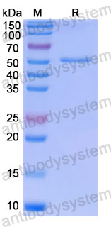Валидация SDS-PAGE - AntibodySystem VHJ62501