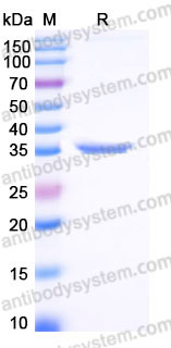 EHB92401, SDS-PAGE