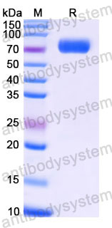 EHC39804, SDS-PAGE