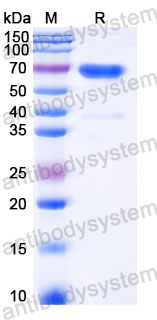 EHC41802, SDS-PAGE