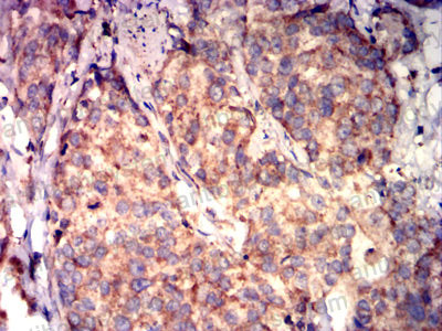 Валидация AntibodySystem RHJ55601 (3465)