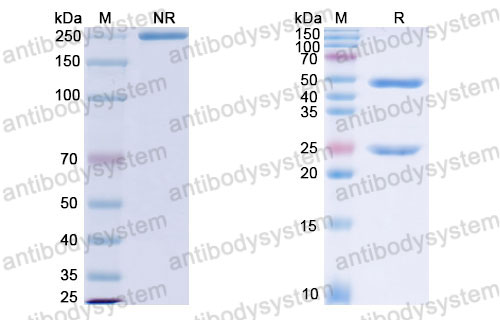 Валидация SDS-PAGE - AntibodySystem DHB87902