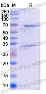 Валидация SDS-PAGE - AntibodySystem DHJ04004
