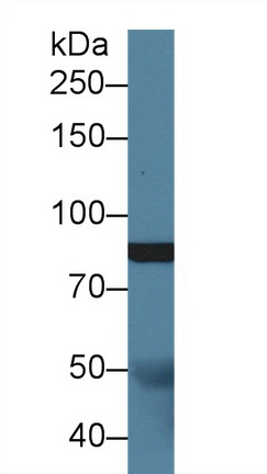 12398