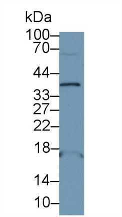 13140