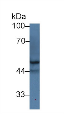 14295