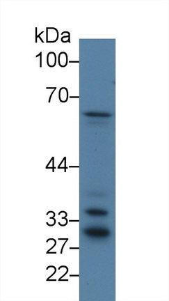 14242