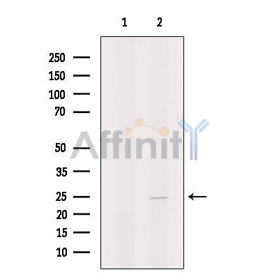 Валидация Affinity DF10043 - 5502